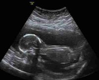 GenXMomma79 profile picture