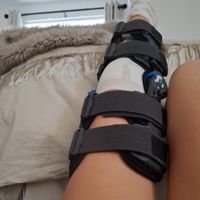 Esthers Knee Surgery Recovery profile picture