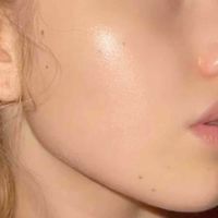 Pimples GO profile picture