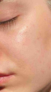 Milas Skin profile picture